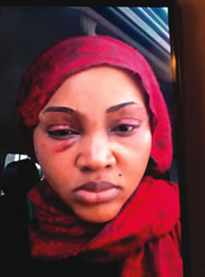 Domestic violence: Mercy Aigbe’s battered face causes stir ...
